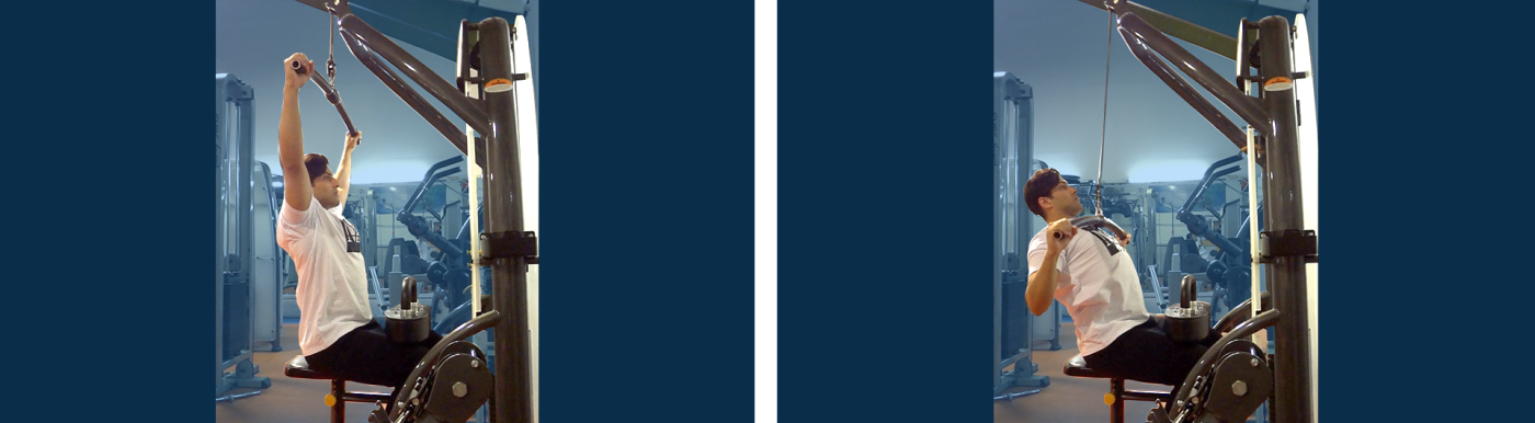 زیربغل-سیم-کش-دست-باز-از-روبرو